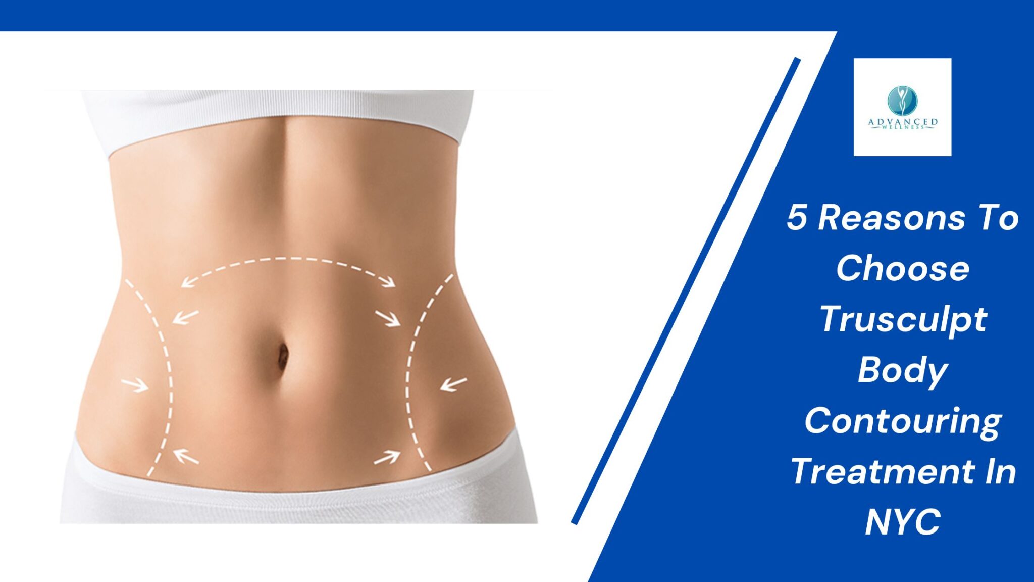 Muscle Contouring Can I Go with the Trusculpt Flex Muscle Sculpting Treatment? - Advanced ...